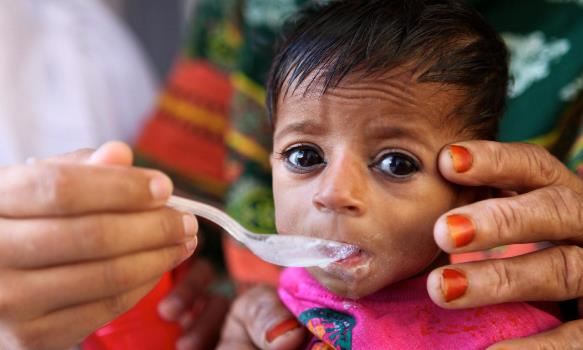 २० वर्ष नपुग्दै विवाह : अधिकांश बच्चा कुपोषित
