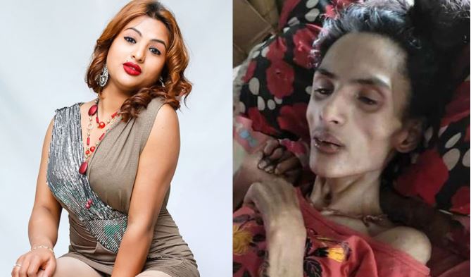 मोडल निशा घिमिरेको उपचारमा ५० लाखभन्दा धेरै खर्च, कस्तो छ अवस्था ?