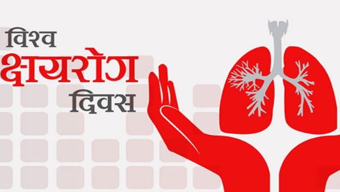 विश्व क्षयरोग दिवस : नेपालमा ३२ हजार क्षयरोगी उपचारबाट वञ्चित