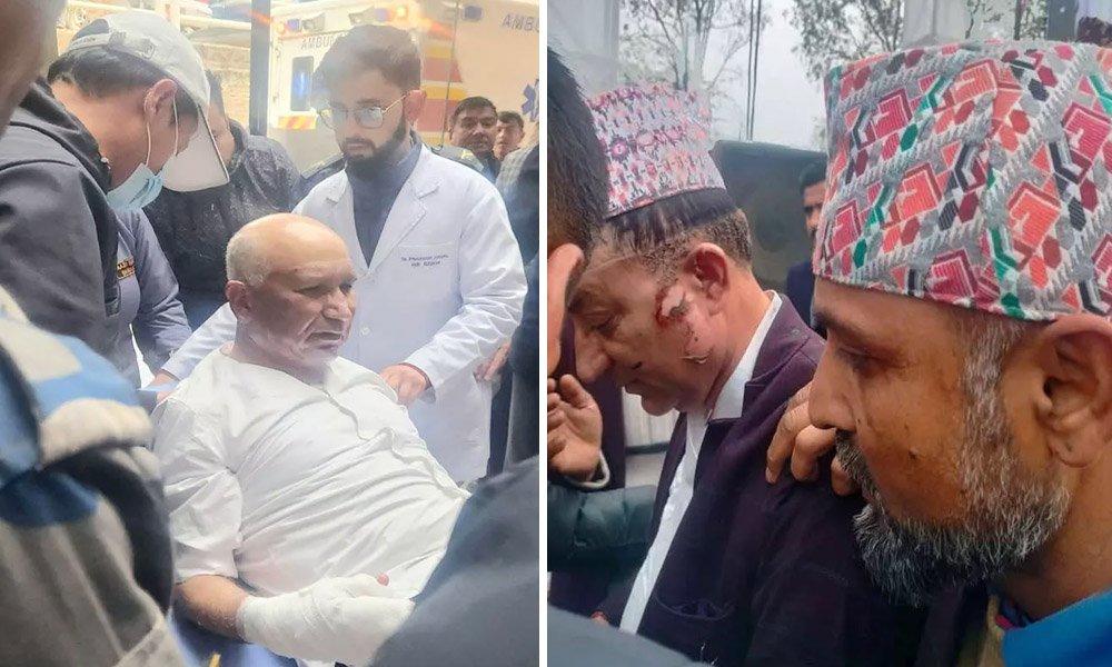 अर्थमन्त्री पौडेल अस्पतालबाट डिस्चार्ज हुँदै, मेयर अचार्यको भने थप उपचार आवश्यक